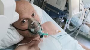 Bald and bankrupt covid-19 serbia